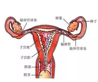 育龄女性都应该知道的输卵管堵塞知识！