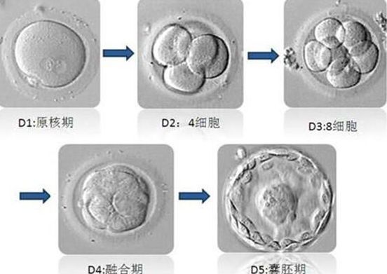 美国试管婴儿