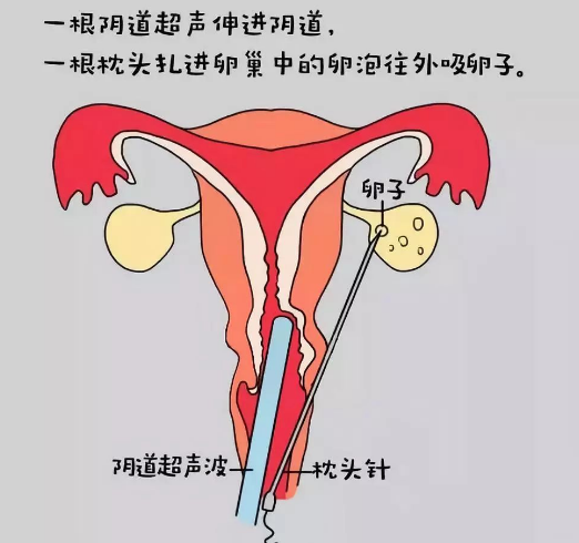 QQ图片20190114164948.png
