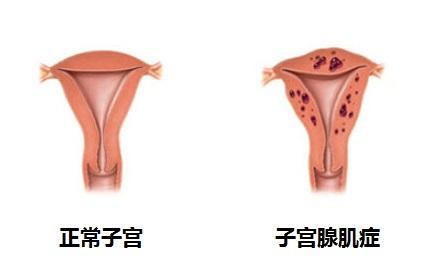 下载 (1).jpg