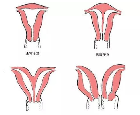 QQ图片20210413094623.png